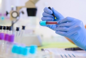Ученые в США изучают универсальный анализ крови на рак