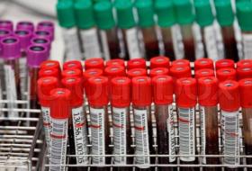 Ученые выяснили, с какой группой крови выше шанс умереть от травмы
