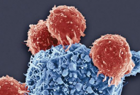 Ученые создали антитела, способные побороть ВИЧ